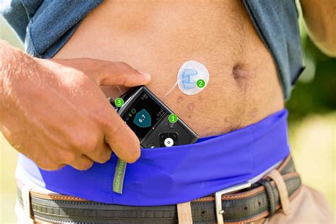 Insulin Pumps For Treating Type Diabetes