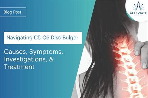 C5 C6 Disc Bulge Causes Symptoms Investigations And Treatment Options
