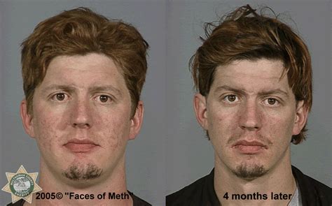 Photos Before And After Mugshots Of Meth Users Wjla