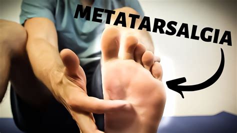 Ball Of Foot Pain Home Diagnosis And Treatment Guide