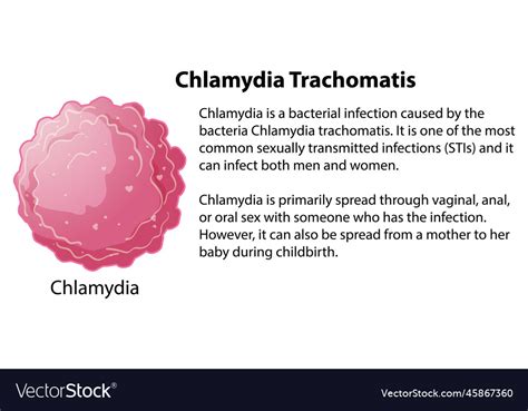 Chlamydia Trachomatis With Explanation Royalty Free Vector