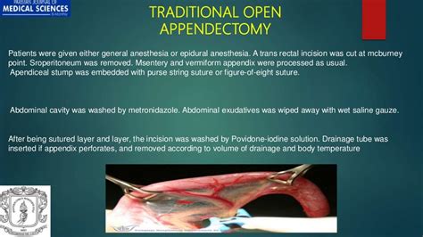 Comparison Of Laparoscopic Appendectomy With Open Appendectomy In Tre