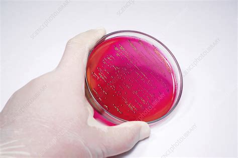 Escherichia Coli Bacteria On Blood Agar Stock Image F0323248