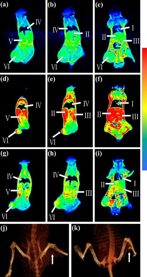 Ac T Weighted Mri Of Nude Mice Bearing Kb Tumor Without Aunr Cupda