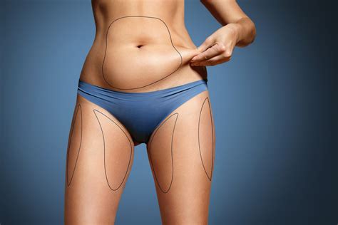 How Much Fat Can Be Removed With Smart Lipo Ellsmore Chiera