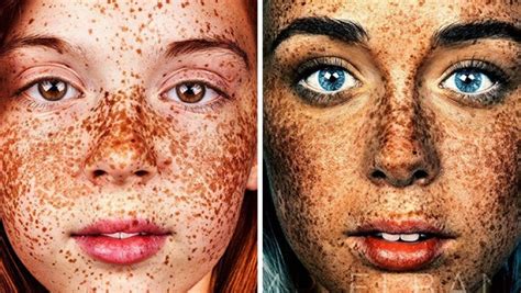 Brock Elbank S Photographs Of The Special Beauty Of Freckled People