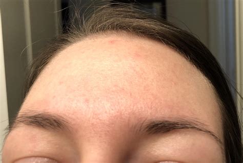 Skin Concerns I Started Three New Products This Week I Know I Know