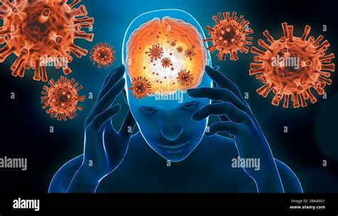 illustration du rendu 3d de l infection virale du cerveau inflammation du cerveau avec des