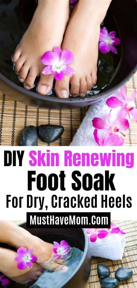 Dry, rough skin on the feet can be more than just a cosmetic issue. DIY Skin Renewing Foot Soak & Dead Skin Remover | Recipe ...