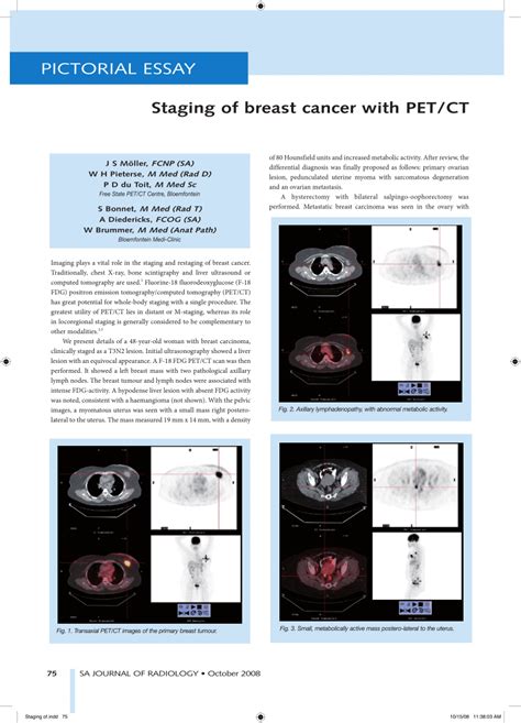 Pdf Staging Of Breast Cancer With Petct