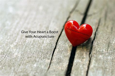 Boca Raton Acupuncture