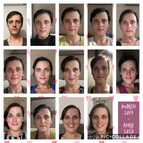 -1 month - 12 months HRT MTF 38 yo : r/transtimelines