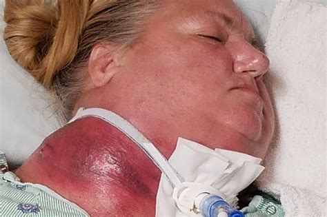 To diagnose throat cancers, doctors may do a physical exam and history, imaging tests, and a biopsy. Fundraiser by Donna Schwall-DeVries : Sister Funeral Fund