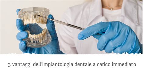 3 Vantaggi Dellimplantologia Dentale A Carico Immediato