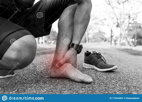 Runner Have Bruise Ankle From Sprain Accident Stock Image Image Of