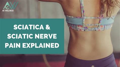 Sciatica And Sciatic Nerve Pain Explained AE Wellness