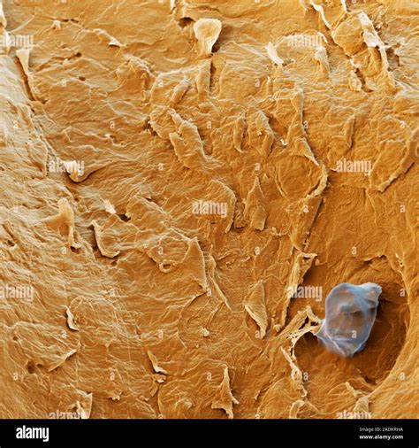 Sweat Pore Coloured Scanning Electron Micrograph Sem Of Sweat Lower