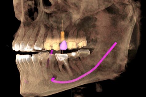 What Is A Dental Cone Beam Ct Midtown Dental