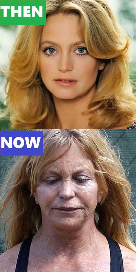23 Celebrities Who Aged Terribly Aging Celebrities Before And After