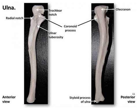 Styloid Process Temporal And Ulnar Complete Anatomy Learn From Doctor