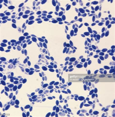 The particles of ink pigment do not enter the capsule that surrounds the spherical yeast cell, resulting in a zone of clearance or halo around the cells. Yeast, Saccharomyces ellipsoideus, seen under a microscope ...