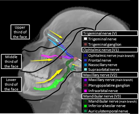 Practical Clinical Guidelines For Contouring The Trigeminal Nerve V