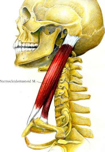 Severe Tighting In The Sternohyoid Muscle Muscle Arises