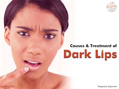 Causes Treatments And Prevention Of Dark Lips How To Lighten Dark Lips