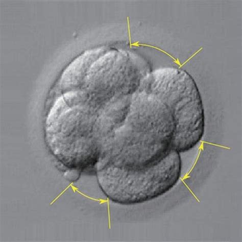 11 Use Of Computer Vision For Embryo Segmentation A 3d Segmentation Download Scientific
