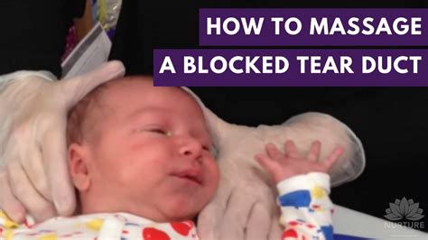 How To Massage A Blocked Tear Duct Youtube