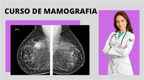 Curso De Mamografia Presencial Youtube