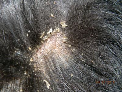 The average adult head grows about 100,000 to 150,000 hairs. How to Stop Dog Hair Loss