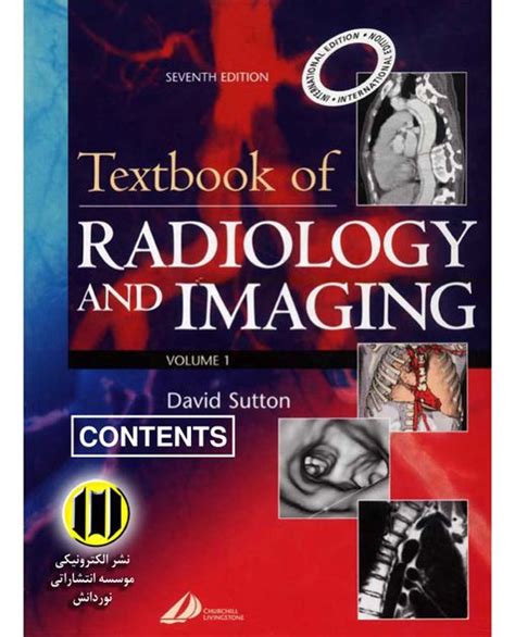 Textbook Of Radiology And Imaging Vol 1 Pdf Pdf Room