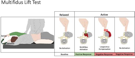 Demonstration Of The Prone Instability Test Pit Download