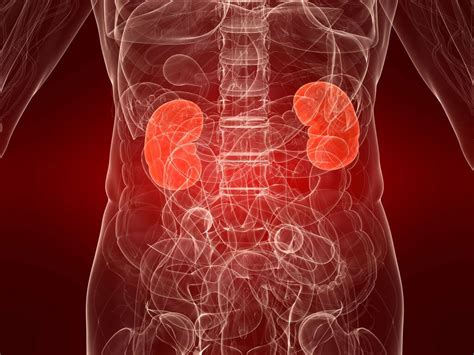Kidney Infection What Is A Kidney Infection