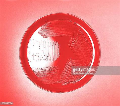 Blood Agar Plate Photos And Premium High Res Pictures Getty Images