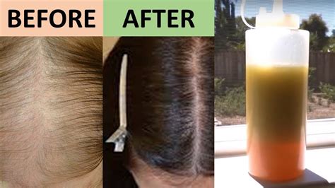 7 Day Hair Growth Miracle Treatment That Promotes Hair Growth From The Roots Natural Home