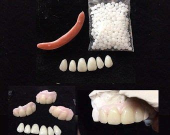 These veneers are fake teeth that snap on over your actual teeth with the goal of improving the these diy dental veneers are still slightly customizable, but faster, cheaper and less effective even. Missing Tooth Veneer Kit Front 6 Teeth Shade A2 False Teeth | Etsy | Veneers teeth, Denture, Teeth