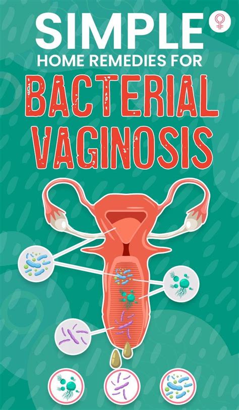 Bacterial Vaginosis Artofit