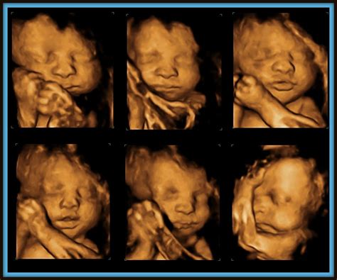 3d Ultrasound At 30 Weeks From Bonus Mom To Bio Mom 3dultrasound