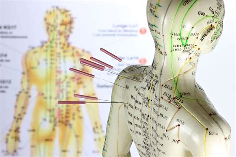 Acupuncture Important Things You Need To Know About Pain