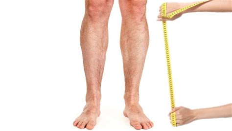 Leg Lengthening Surgery Mostly Attractsyou Guessed It Short Men