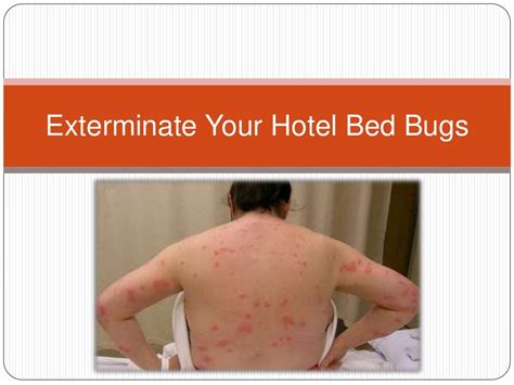 Exterminate Your Hotel Bed Bugs