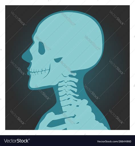X Ray Shot Skull Human Body Head And Neck Vector Image