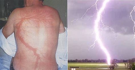 Person Being Struck By Lightning