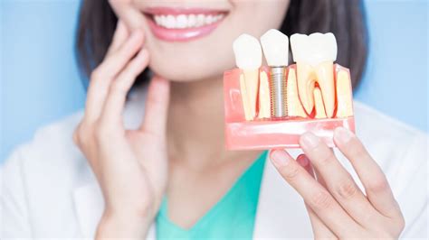 Dental Implants Aftercare Questions Answered Swedish Dental