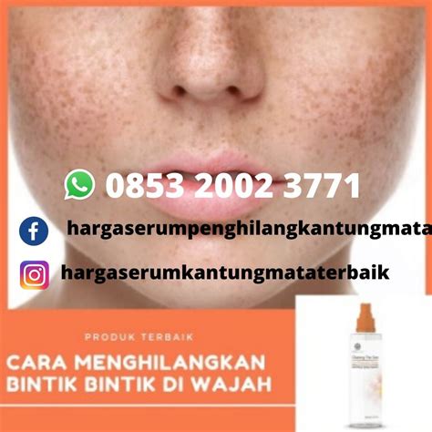 Selain kegiatan yang banyak dilakukan di dalam ruangan, para idol kpop umumnya memakai topi hitam untuk melindungi wajah dari paparan sinar matahari. Cara Perawatan Wajah Remaja Belang Korea | Ideku Unik