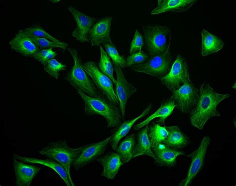 Donkey Anti Rabbit Igg Hl Highly Cross Adsorbed Secondary Antibody