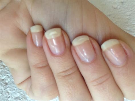 Best Treatments For Nail Recovery After Acrylics Nails After Acrylics