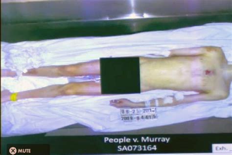 Autopsy Photos Of Michael Jackson The Image Kid Has It